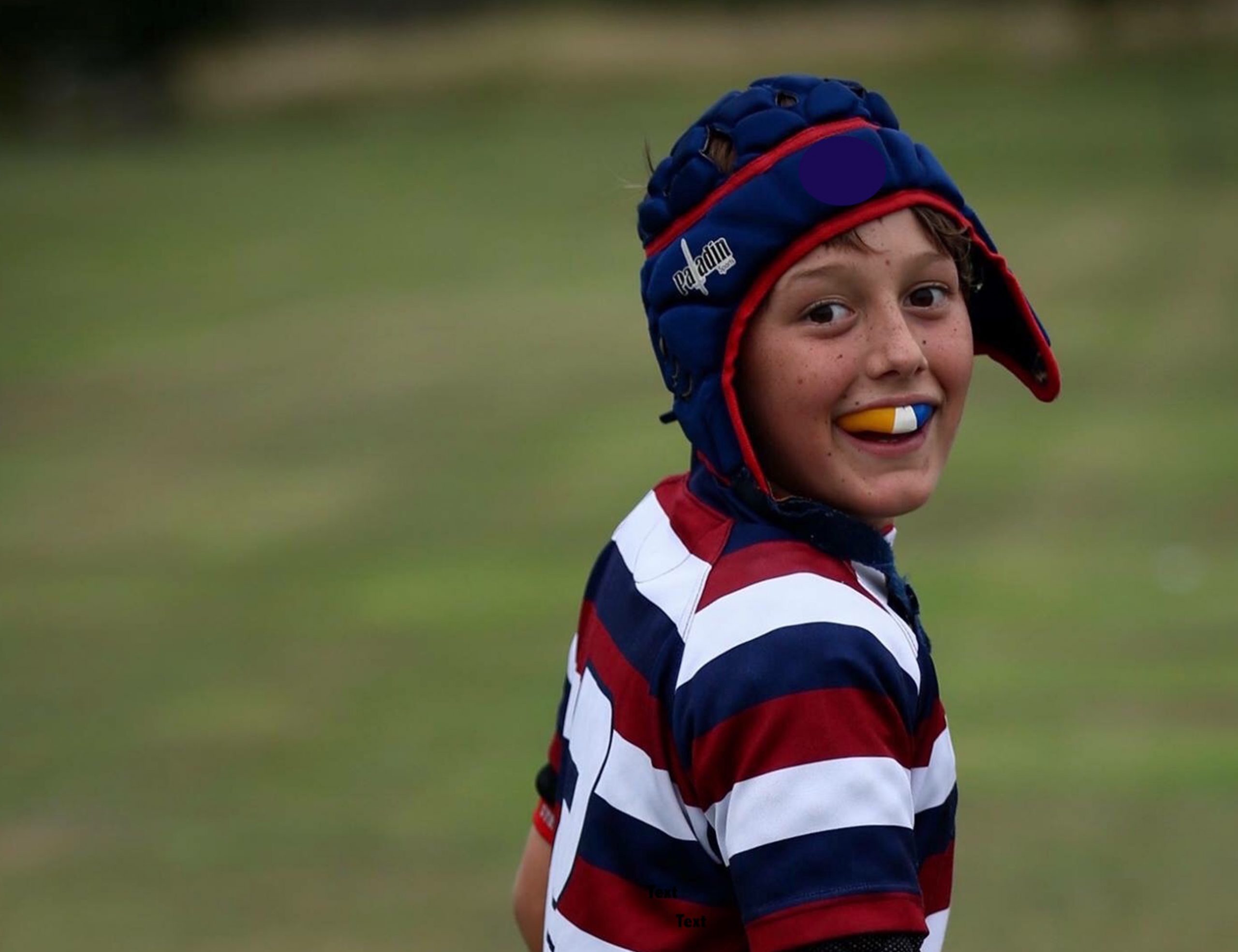 Mouthguards on the Sunshine Coast